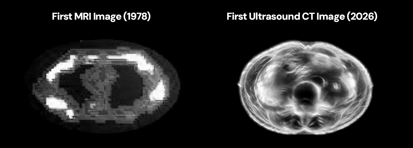 USCT reconstruction compared with an MRI of the same region