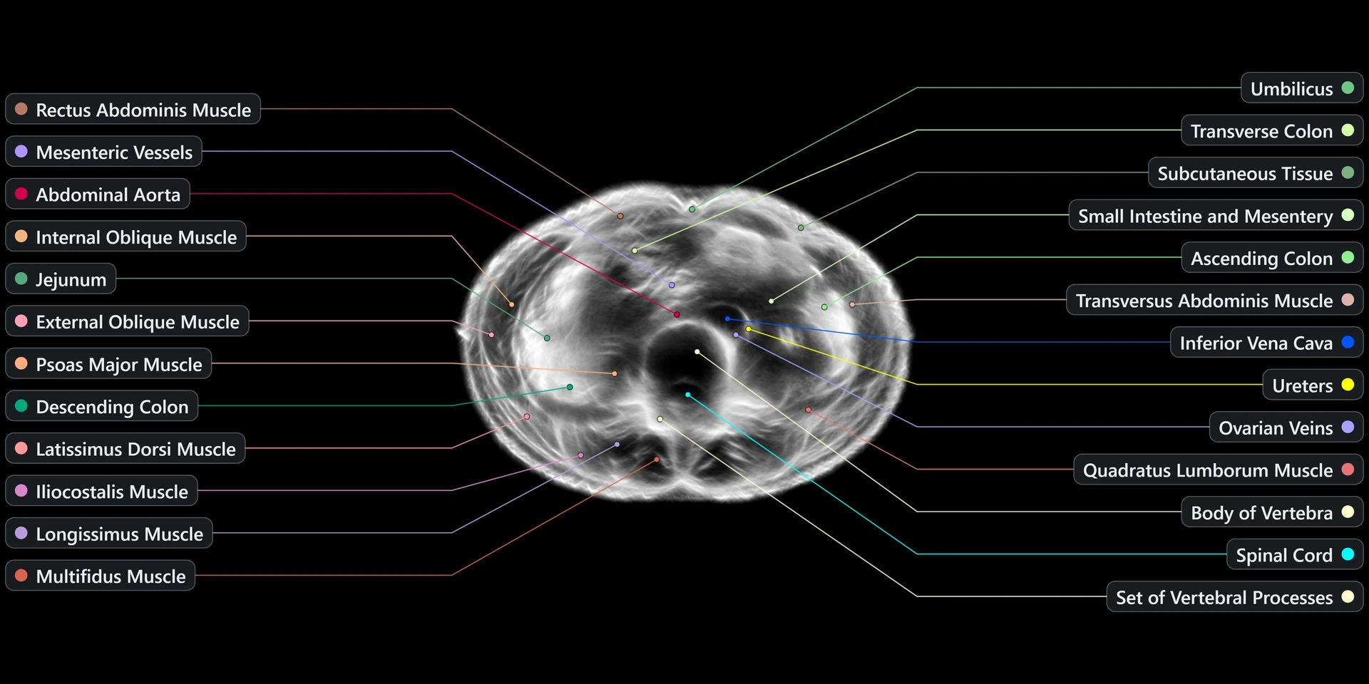 Reconstructed scan slice — female lower abdomen