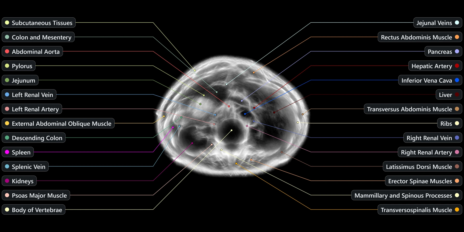 Reconstructed scan slice — female upper abdomen