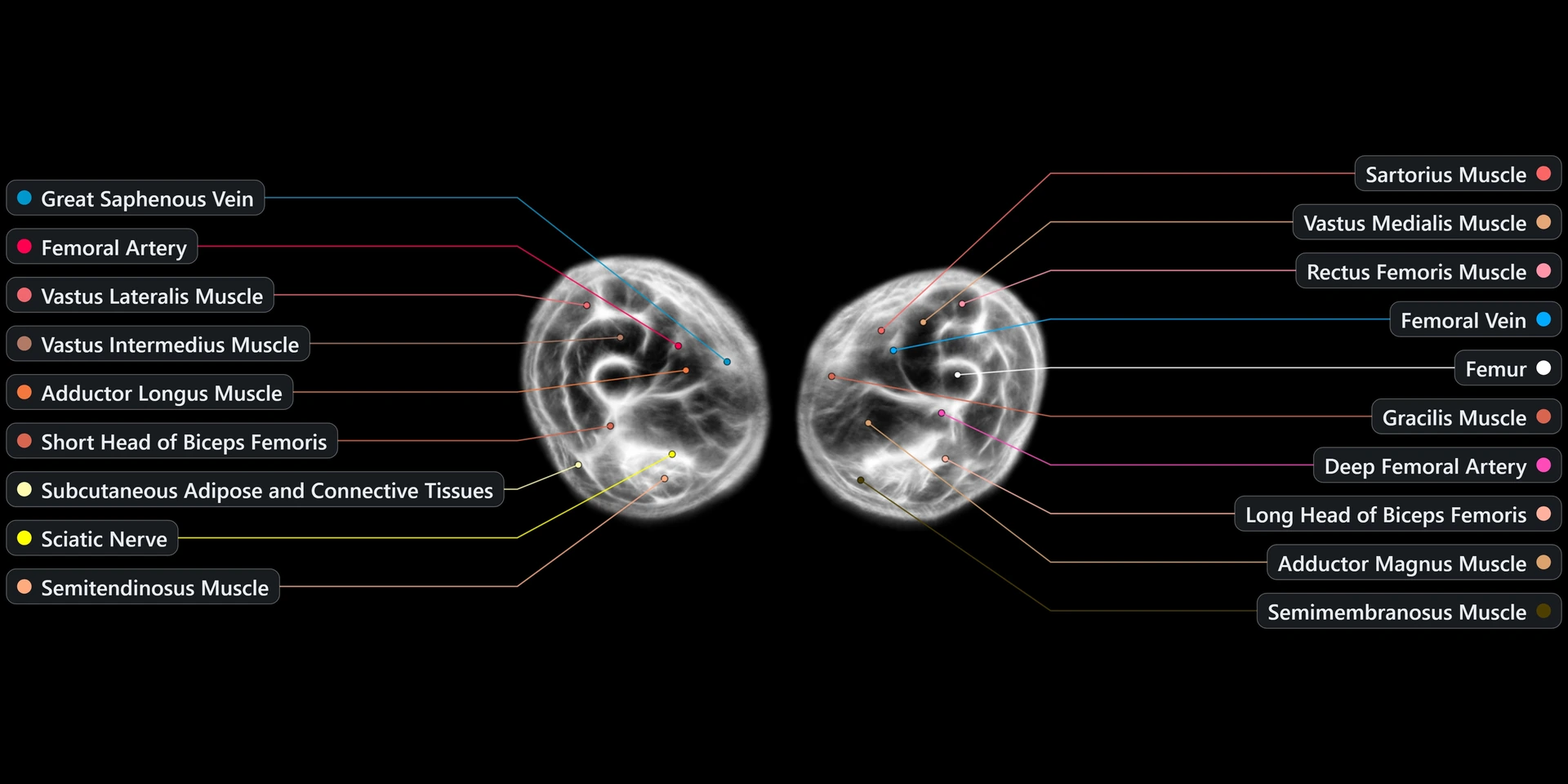 Reconstructed scan slice — male thigh