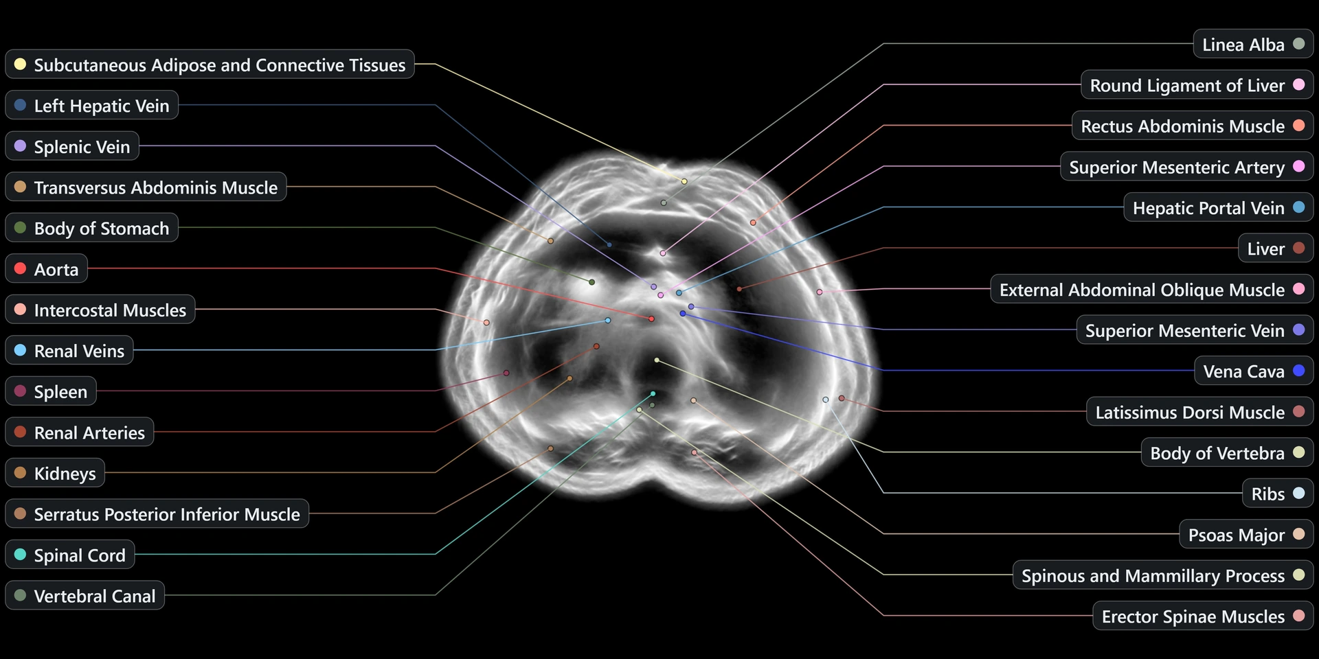 Reconstructed scan slice — male upper abdomen