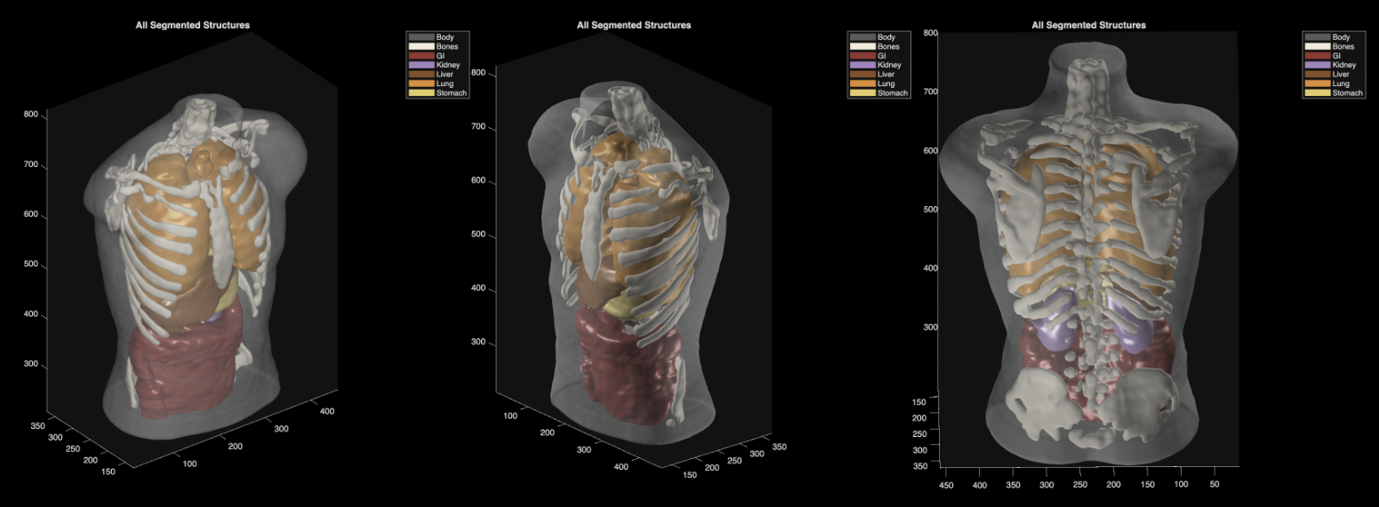 Segmentation of an ultrasound imaging phantom